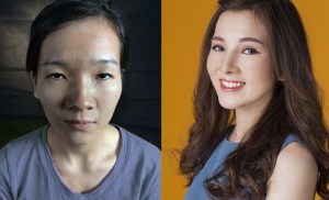 5 ca phẫu thuật thẩm mỹ đại thành công của Việt Nam năm 2017
